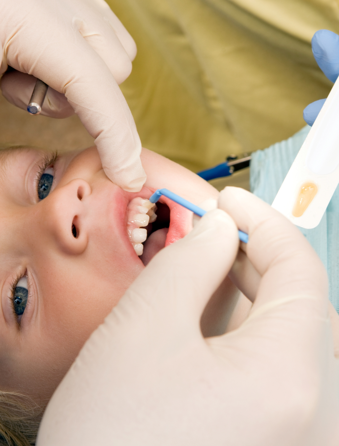 Is Fluoride Bad for You?