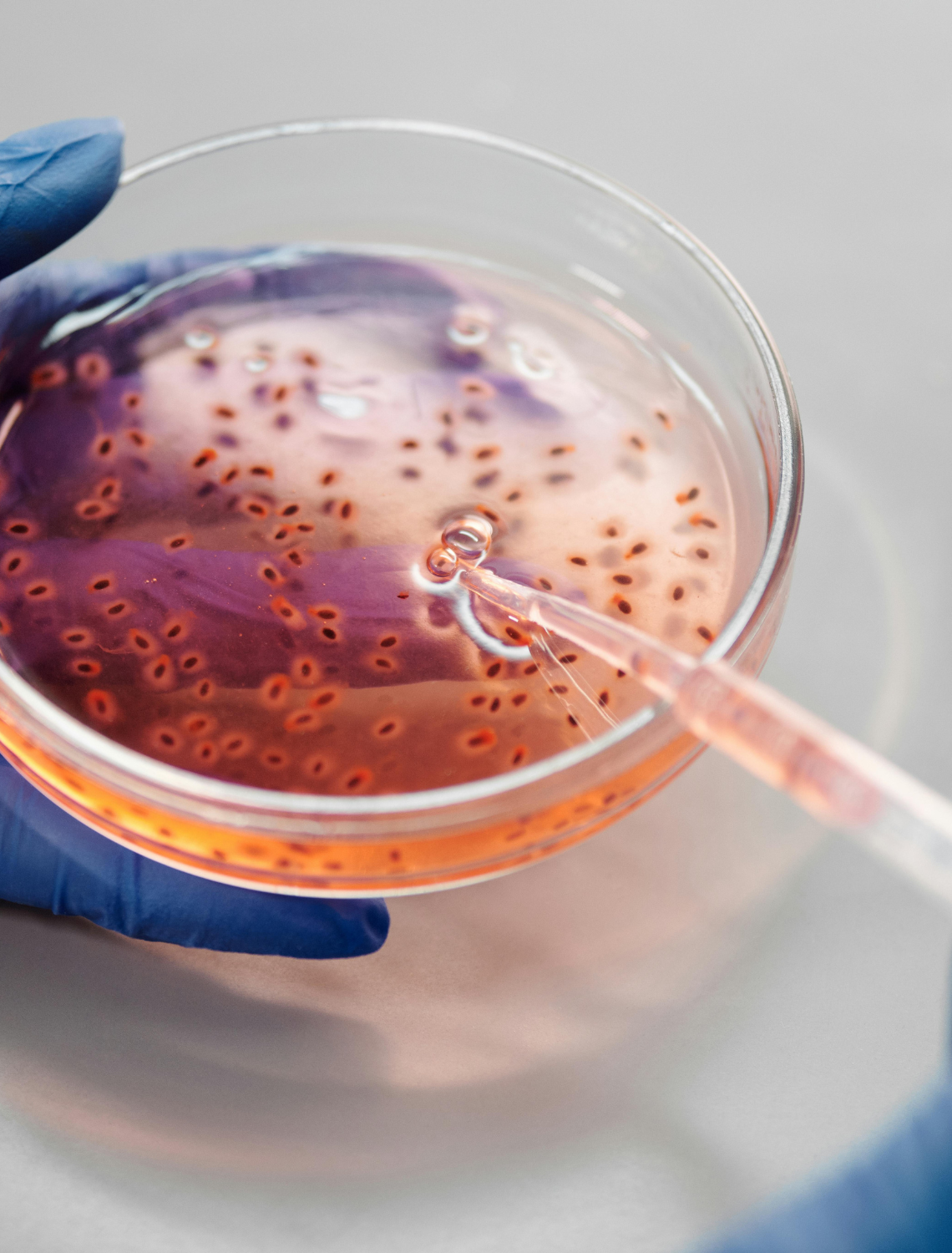 How to Avoid Brain-Eating Amoeba? Complete Guide